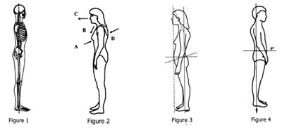 Common Posture Types