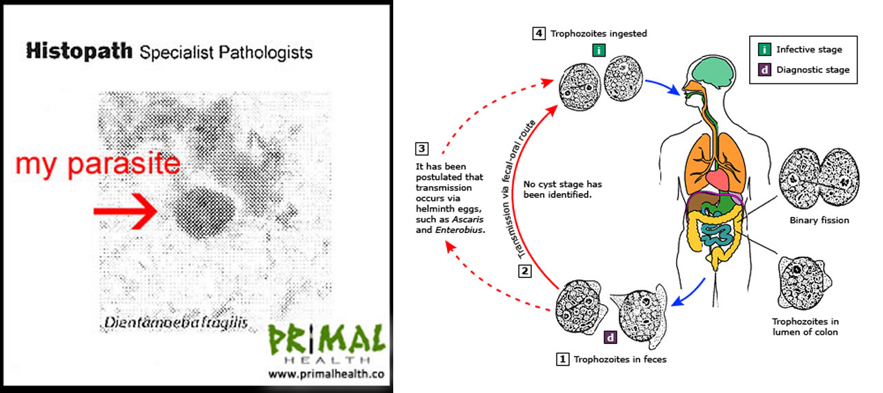 I Have a Parasite Called Dientamoeba Fragilis