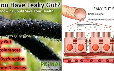 Do You Have a Leaky Gut? Knowing Could Save Your Health!