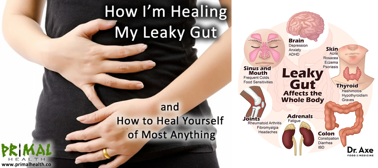 How I'm Healing My Leaky Gut & How To Heal Yourself of Most Anything